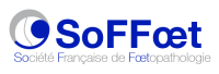 SOFFOET